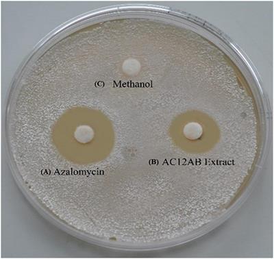 A Potential Biocontrol Agent Streptomycesviolaceusniger AC12AB for Managing Potato Common Scab